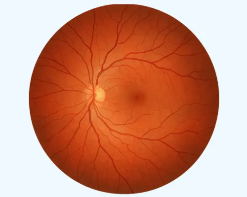 Eye retina